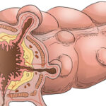 13th Dilemmas & Debates in Colorectal Surgery (DDCRS)